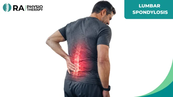 Lumbar Spondylosis