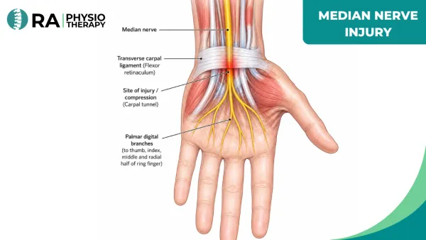 Median Nerve Injury