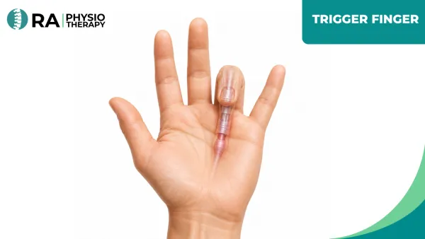 Trigger Finger