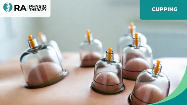 Cupping Therapy
