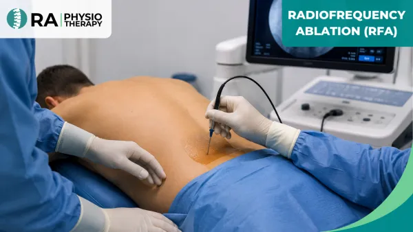 Radiofrequency Ablation (RFA)